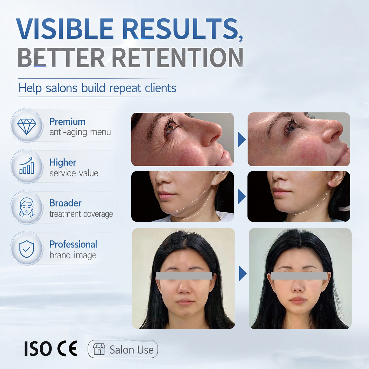 3 in 1 Skin Tightening Machine 50D VMAX RF Facial Rejuvenation Body Slimming Device Face Lifting Beauty - Professional HIFU Lifting equipment by SMIO