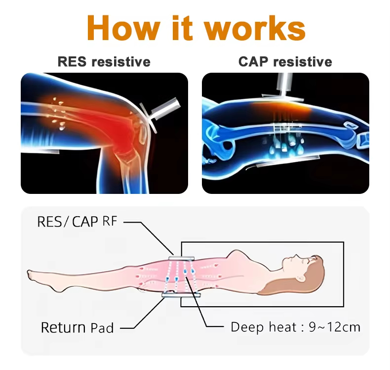 INDIBA 448 Khz Rf Tecar Therapy Ret Cet Rf Radio Frequency 448 K Monopolar Physiotherapy Physio Tecar Therapy Machine - Professional EMS Body Sculpting equipment by SMIO