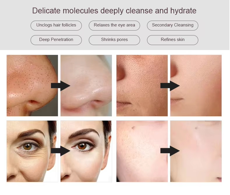 Cold and Hot Double Spray Face Steamer Refreshing Skin Care Deep Cleaning Face Steamer - Professional Professional Beauty Equipment equipment by SMIO