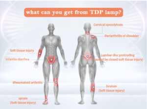 TDP Heat Lamp
