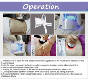 Dual Handle Cryolipolysis Machine