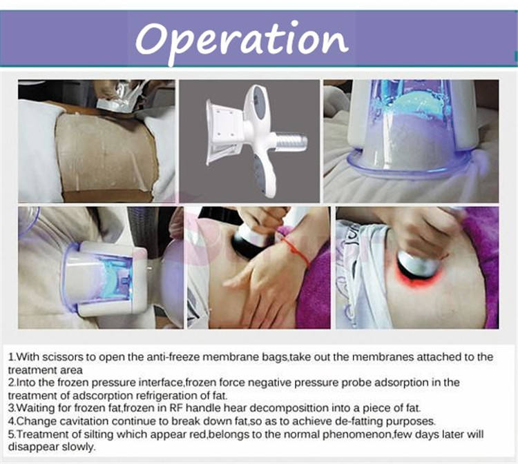 - SMIO #138 - Professional Professional Beauty Equipment equipment by SMIO
