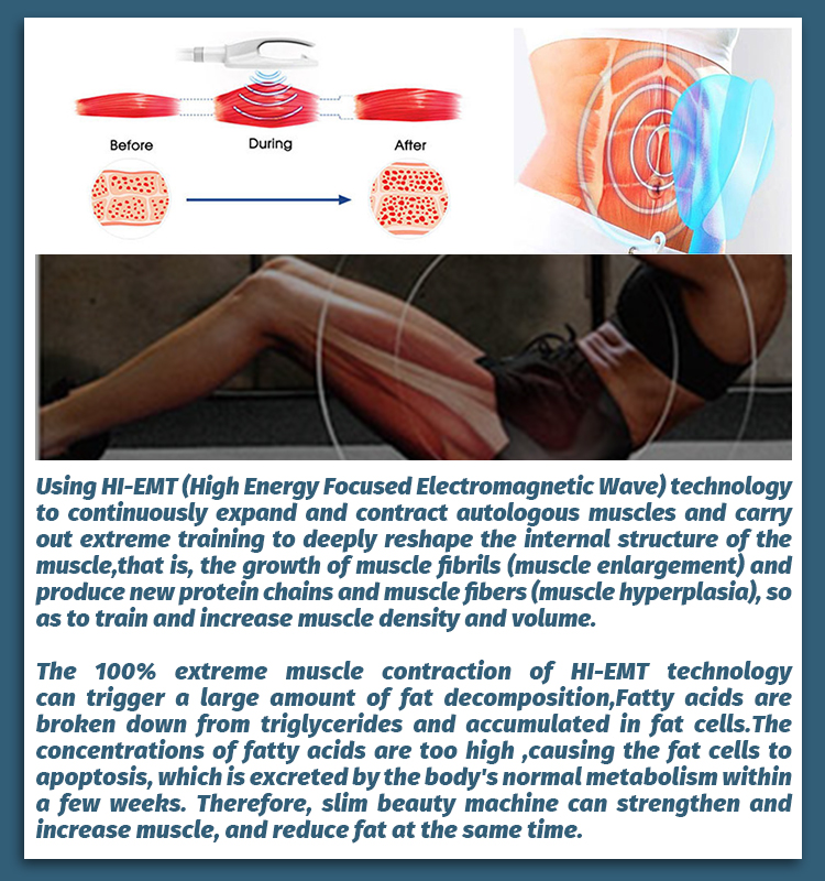 式EMS - SMIO #151 - Professional EMS Body Sculpting equipment by SMIO
