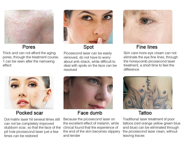 单手柄立式皮秒 - SMIO #158 - Professional Picosecond / CO2 / Nd:YAG Laser equipment by SMIO