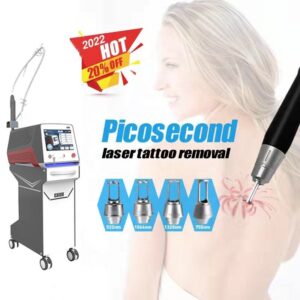 Picosecond Laser Tattoo Removal