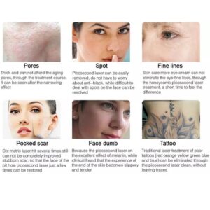 台式皮秒 - SMIO #175 - Professional Picosecond / CO2 / Nd:YAG Laser equipment by SMIO