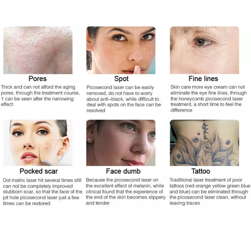 台式皮秒 - SMIO #175 - Professional Picosecond / CO2 / Nd:YAG Laser equipment by SMIO