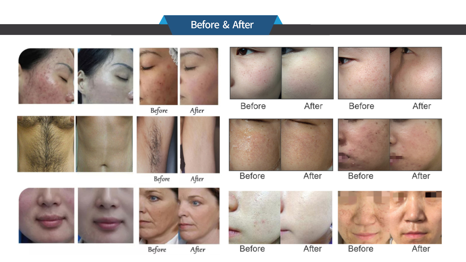 科雷亚 - SMIO #182 - Professional Professional Beauty Equipment equipment by SMIO