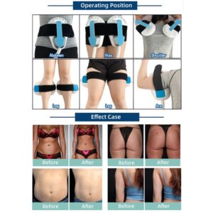 EMS 台式 2手柄 - SMIO #223 - Professional EMS Body Sculpting equipment by SMIO