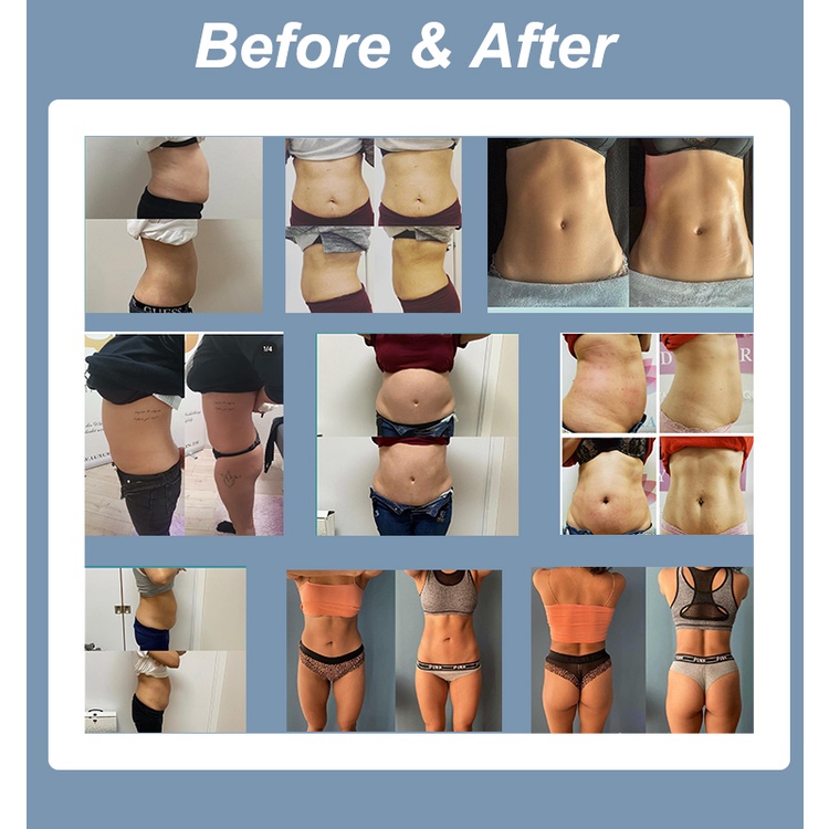 EMS 台式 2手柄 - SMIO #223 - Professional EMS Body Sculpting equipment by SMIO