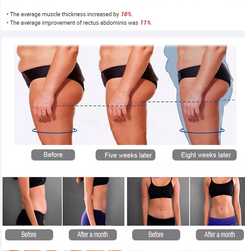 台式 EMS 4手柄 - SMIO #226 - Professional EMS Body Sculpting equipment by SMIO