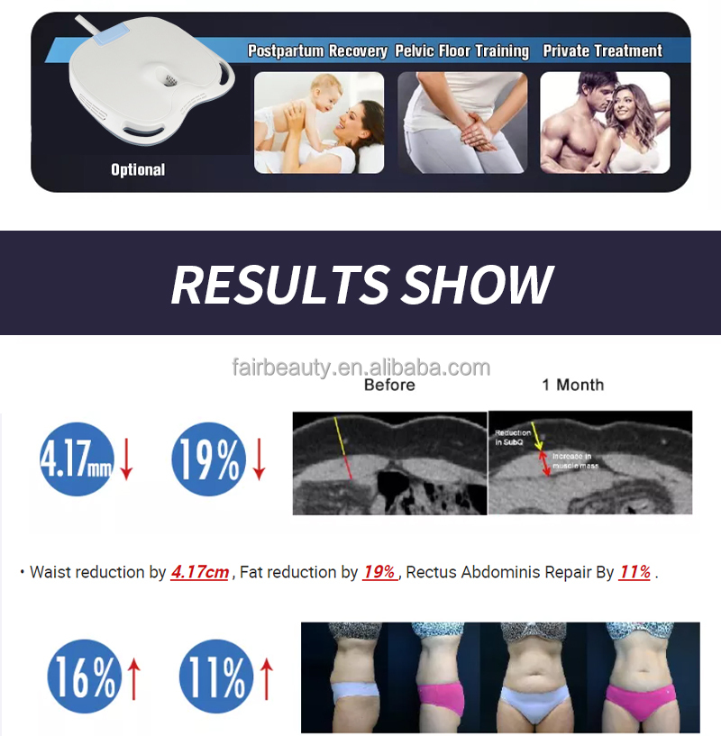 台式 EMS 4手柄 - SMIO #226 - Professional EMS Body Sculpting equipment by SMIO