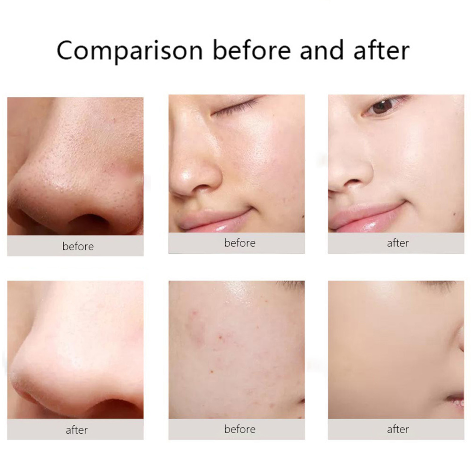 水动力皮肤皮肤管理仪 - SMIO #278 - Professional Professional Beauty Equipment equipment by SMIO