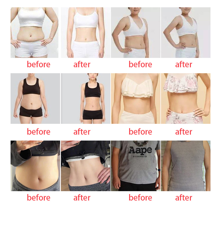 台式EMS 6手柄 - SMIO #309 - Professional EMS Body Sculpting equipment by SMIO