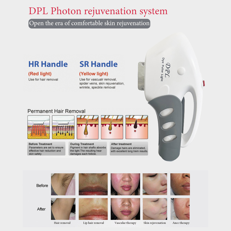 双DPL - SMIO #326 - Professional Professional Beauty Equipment equipment by SMIO