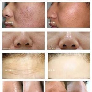 黑珍珠10手柄 - SMIO #328 - Professional Professional Beauty Equipment equipment by SMIO