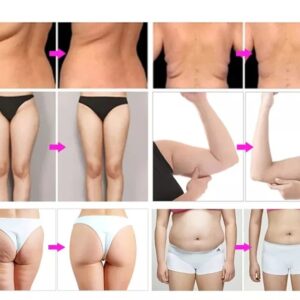9合1 爆脂减肥机 - SMIO #330 - Professional Body Sculpting / Fat Reduction equipment by SMIO