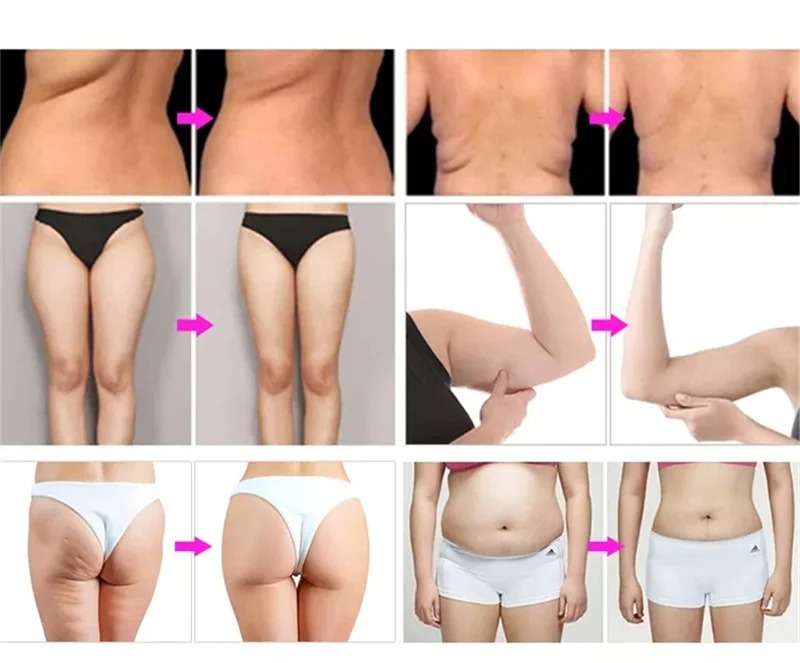 9合1 爆脂减肥机 - SMIO #330 - Professional Body Sculpting / Fat Reduction equipment by SMIO