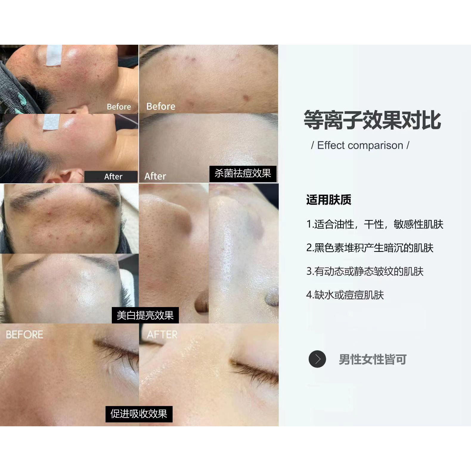 全息综合仪 点震刀 - SMIO #353 - Professional Professional Beauty Equipment equipment by SMIO