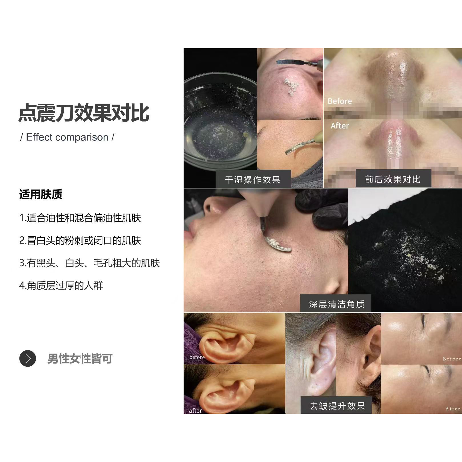 全息综合仪 点震刀 - SMIO #353 - Professional Professional Beauty Equipment equipment by SMIO