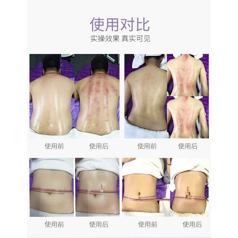 Body Sculpting Slimming Results