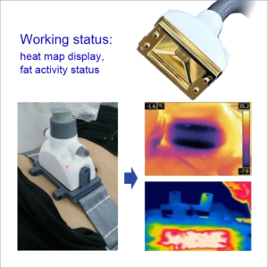 EMS Heat Map Body Sculpting Machine