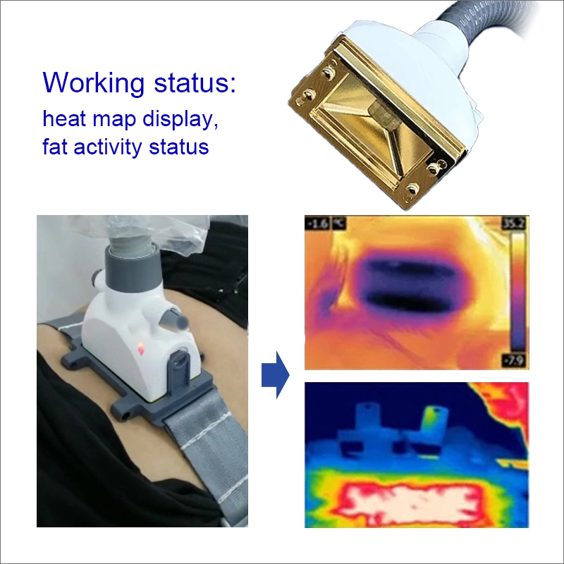 EMS Heat Map Body Sculpting Machine