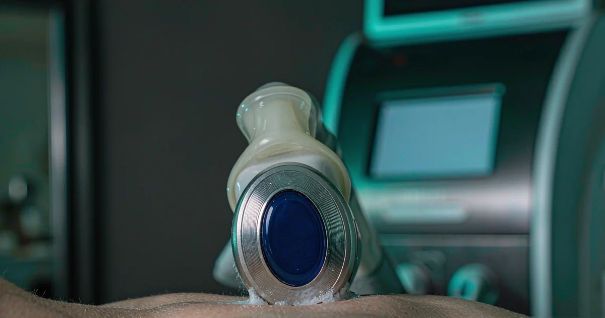 Sapphire contact-cooling laser tip chilled against skin during treatment